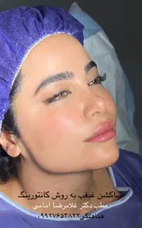 جشنواره ساکشن غبغب توسط فوق تخصص جراح پلاستیک