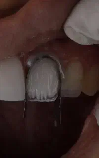 لمینت با شرایط اقساطی