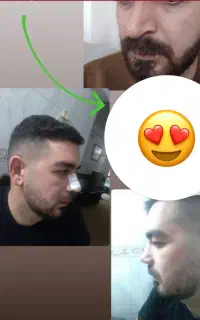 عمل بینی فقط با۲۹میلیون تومان