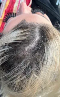 پاکسازی پوست سرو پدیکورپا