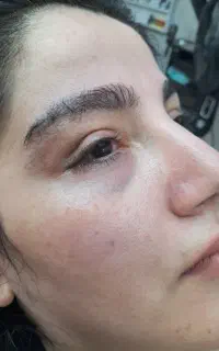 پذیرش مدل اصلاح و قرینه سازی ابرو