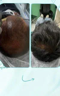 یه تخفیف ویژه به مناسبت یک سالگی کلینیک آرومای