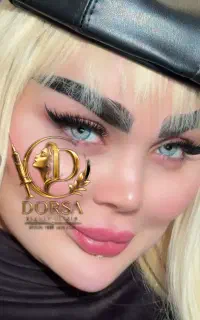 50% تخفیف تزریق تخصصی ژل وبوتاکس مادلینگ هایفو مزو