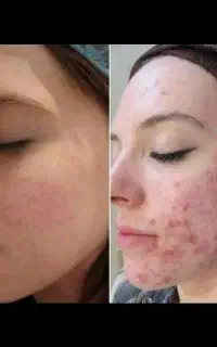 لیزر/هایفو/فیشیال/ژل و بوتاکس/جراحی های سرپایی