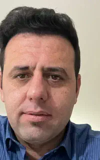 کاشت مو ریش ابرو