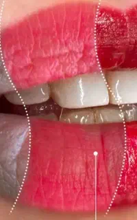 (تتوی دائم صورت)