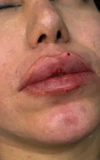جشنواره بزرگ تخفیف برای تمام جراحی ها