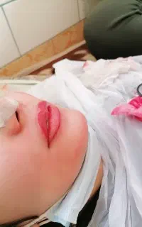 فشیال ورفع تیرگی لب