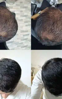 کاشت ممنوع