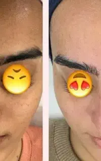 فیشیال پوست