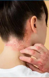 دوای دردت پیش منه