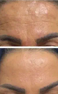 تخفیفی بیوممتیک جهانی ...موجودی محدود