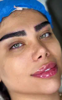 کاشت مو ابرو تخصصی تهران