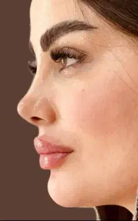 عمل بینی لیپو ابدو مامو لیفت پیکر تراشی بلفا قسطی