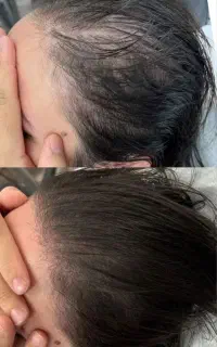 پی آر پی ممنوع