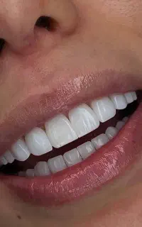 دندانپزشکی ویانا.اقساطی