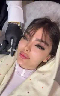 آموزش تزریق ژل وبوتاکس کلینیک  ،پی ارپی ، بایوفیلر
