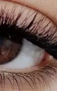 کاشت مژه فقط ۳۷۰ خیابان جهاد