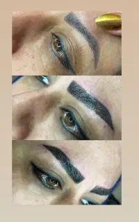خداحافظی‌باتاتوی تیره وبدرنگ بدون ریموولیزرتک جلسه