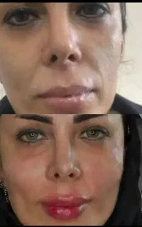 جوان سازی و زیباسازی پوست