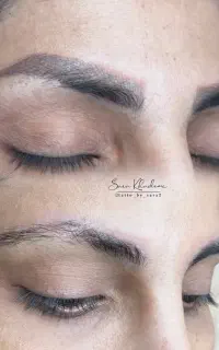 ریموو تتو بانوان
