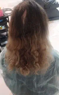 احیای مو