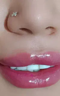 جشنواره تخفیفات ویژه ژل وبوتاکس