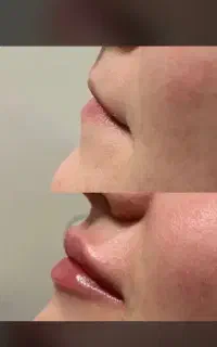 انجام خدمات زیبایی