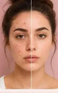 پاکسازی صورت با تخفیف ویژه