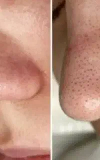 جشنواره کراتین و پروتئین تراپی مو