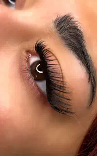 کاشت مژه/کاشت هیدن