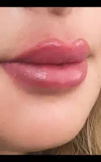 جشنواره فیلر بادی پی ارپی ژل،نخ مایع ،بایوفیلر