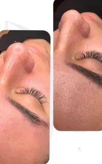 پاکسازی و فیشال تخصصی خانم ها و آقایان