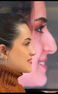 فرصت عالی جراحی بینی