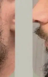 ریشاتو مثل چمن پر کن