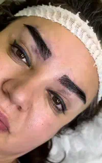 کاشت مو ابرو  ریش