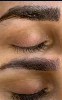 آموزش و خدمات تخصصی ریموو تتو صورت