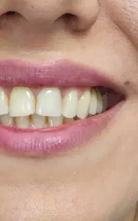 استخدام