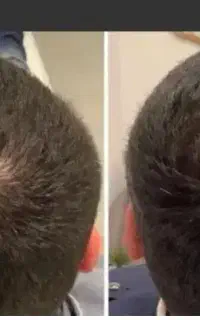 کاشت ممنوع