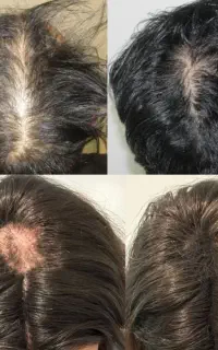 شونه لای موهات گیر میکنه