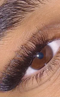 کاشت موقت ۲۰۰ ۲۵۰ ۲۸۰