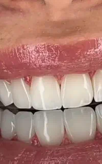 دندانپزشکی و دندانسازی پارسیان