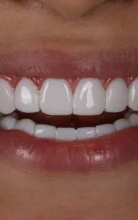 خدمات زیبایی دندان گلد دنت