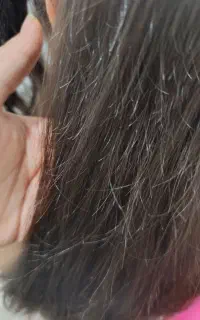 ofویژه موخوره گیری به مدت 10روز