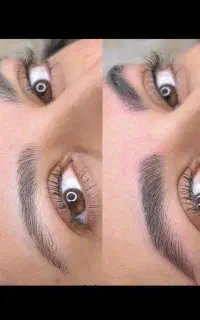میکروبلیدینگ و فیبروز ابرو به سبک سوپرنچرال