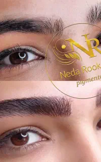 میکروبلیدینگ،فیبروز(خانومامشتری بیارید درصدبگیرید)