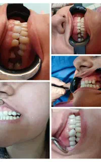 خدمات دندانپزشکی با بهترین مواد و متریال