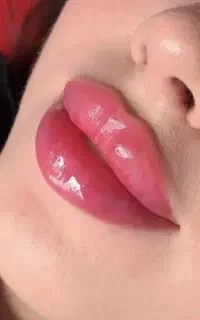 مدل جهت زیبایی توسط پزشک