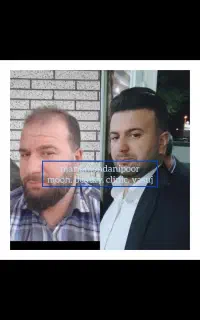 کلینیک زیبایی ماه کاشت و تزریق