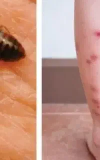 سمپاشی منزل ساس سوسک کل کرج سراسیاب ملارد صفادشت